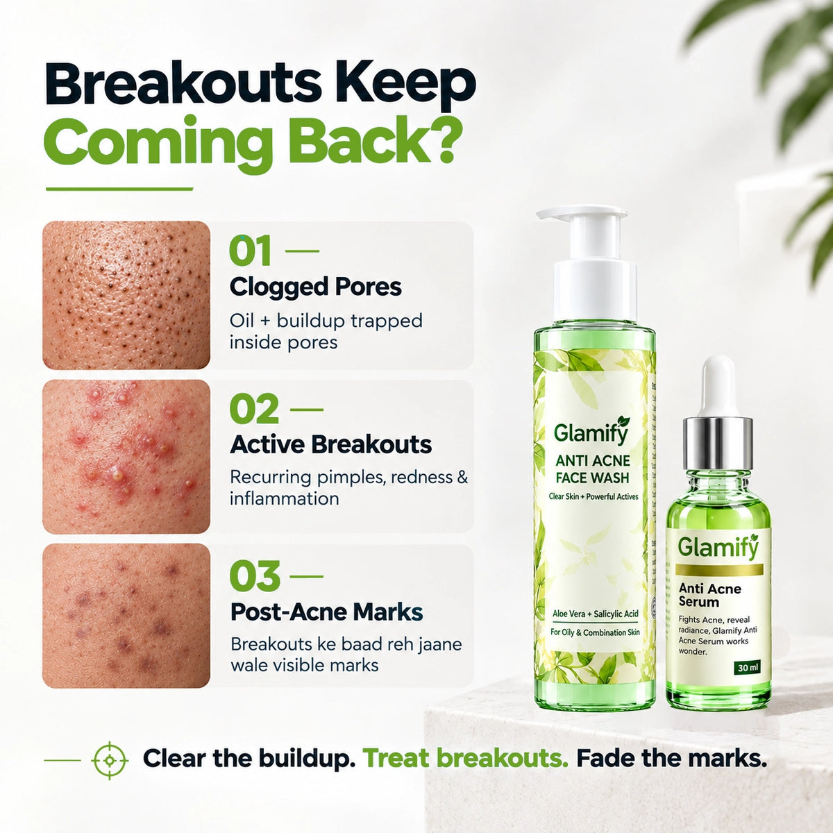 ACNE KILLER DUO — SAVE Rs 470